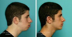 before-after-patients-13.jpg