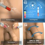 MedicalMex-Enlargement-of-the-Penis-with-Liposuction-and-Transfer-without-Lengthening-mob.jpg