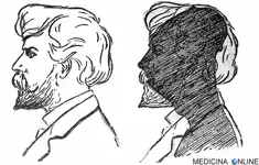dott.-emilio-alessio-loiacono-medico-chirurgo-direttore-medicina-online-esempio-di-incel-bird...webp